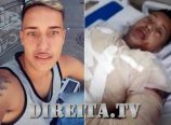 Jovem teve 60% do corpo queimado pela ex-namorada por não aceitar o fim do relacionamento